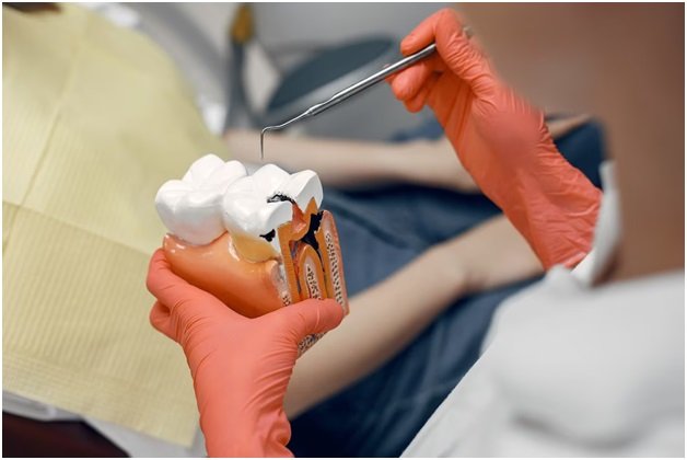 Everything You Need to Know About Wisdom Tooth Removal